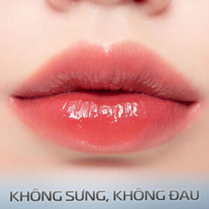 Cấy Môi Thanh Xuân – Bí Quyết Sở Hữu Đôi Môi Căng Mọng, Đẹp Tự Nhiên Ngay Cả Khi Để Mặt Mộc Cơ sở