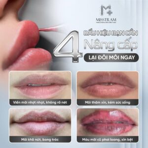Phun Môi Thẩm Mỹ: 4 Dấu Hiệu Bạn Cần "Nâng Cấp" Đôi Môi Ngay Lập Tức! Toàn diện