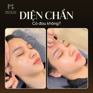 Diện Chẩn Có Đau Không? Cảm Giác Khi Trị Liệu Diện Chẩn Là Như Thế Nào? Bạn đã nghe