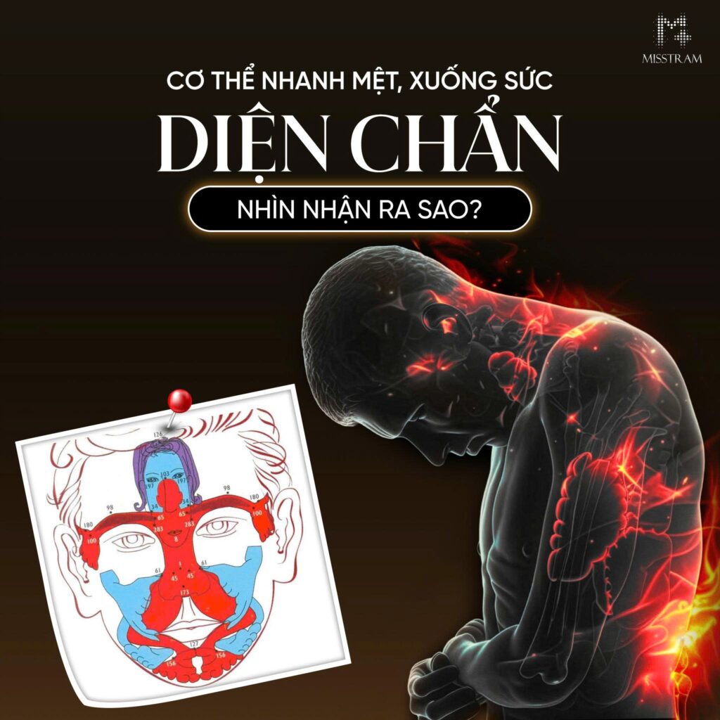 Cơ Thể Nhanh Mệt, Xuống Sức – Diện Chẩn Nhìn Nhận Và Hỗ Trợ Như Thế Nào? Trực tiếp Cơ Thể Nhanh Mệt, Xuống Sức – Diện Chẩn Nhìn Nhận Và Hỗ Trợ Như Thế Nào? Trực tiếp