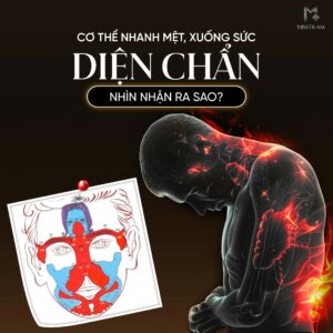 Cơ Thể Nhanh Mệt, Xuống Sức – Diện Chẩn Nhìn Nhận Và Hỗ Trợ Như Thế Nào? Đơn giản