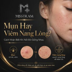 Mụn Hay Viêm Nang Lông? Cách Nhận Biết Khi Nốt Đỏ Giống Nhau Đặc biệt
